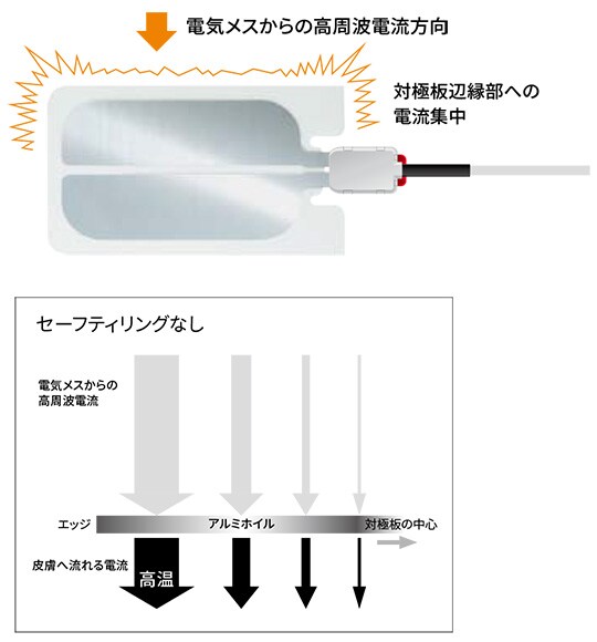 (１)電流を対極板全体に分散させる特殊構造①
