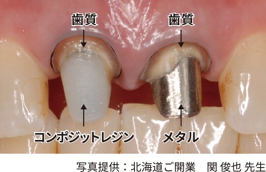 シンプルな術式
