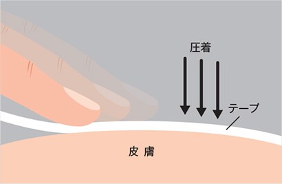 テープ貼り方１
