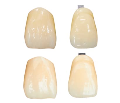 新製品（左）とガイド歯（右）との比較 上：蛍光灯下、下：太陽光下
