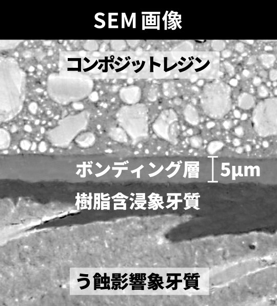SEM画像