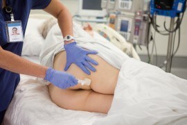 被膜剤を使用したIAD（失禁関連皮膚炎）対策～ICUでの取り組み～