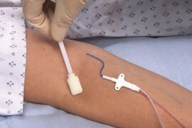 被膜剤を活用したスキン-テア(皮膚裂傷)対策とIAD(失禁関連皮膚炎)対策
