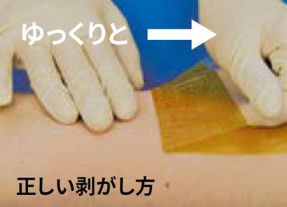 アイオバンの剥がし方２
