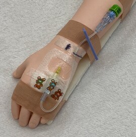 血管留置カテーテルの管理