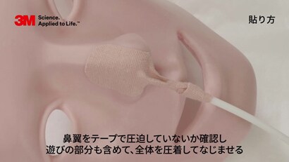 経鼻チューブの固定方法
