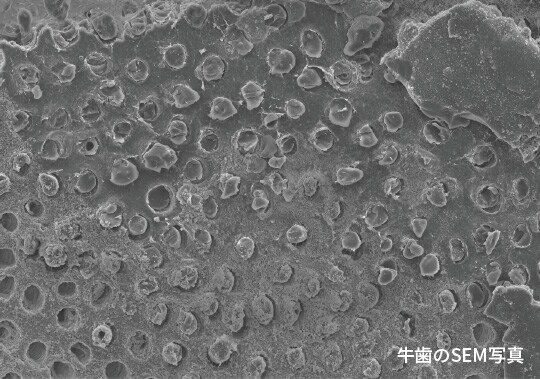 塗布した部分において、歯面の表面から取り除かれた後も象牙細管は封鎖されている（牛歯のSEM写真）
