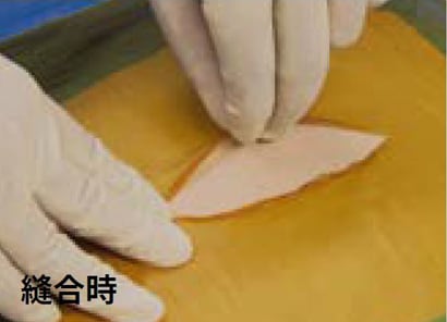アイオバンの剥がし方１
