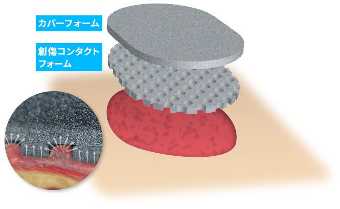  V.A.C.® ベラフロクレンズチョイスフォーム™ の特長

