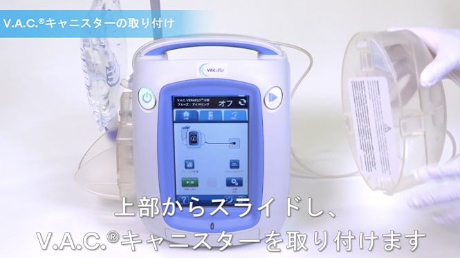 キャニスターの取扱い
