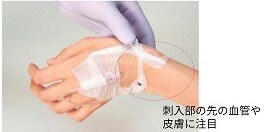 フィルムドレッシング材に関連した注意事項
