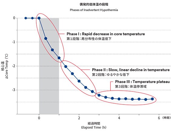 周術期低体温の原因とパターン
