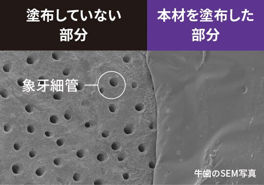塗布していない部分、本材を塗布した部分（牛歯のSEM写真）
