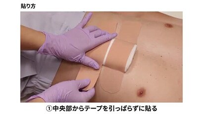 伸縮テープの貼り方・剥がし方動画
