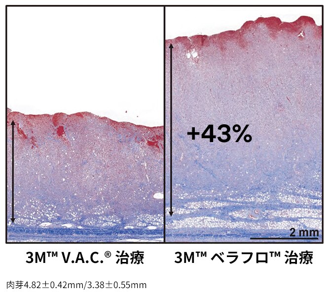 肉芽形成を促進
