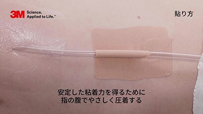 胸腔ドレーンの固定方法動画
