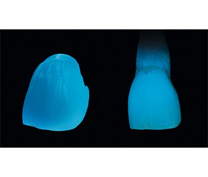 新製品（左）と天然歯（右） 蛍光性を含有しているため、UV ライト下で発光
