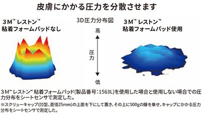 皮膚にかかる圧力を分散させます