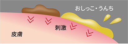おしっこ・うんちとの接触
