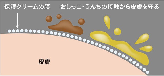 保護クリームの膜がおしっこ・うんちの接触から皮膚を守る
