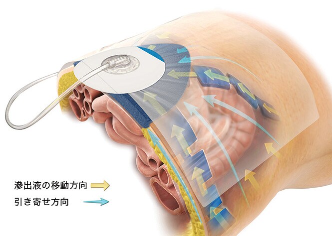 製品使用イメージ図（1）
