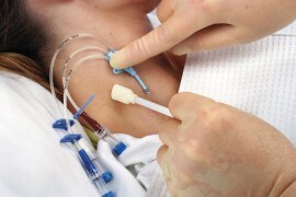 中心静脈カテーテル挿入部位への皮膜剤使用～感染対策の観点から～