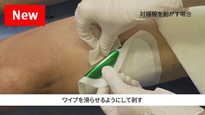 剥離剤と皮膜剤の使い分けによる皮膚トラブル対策
