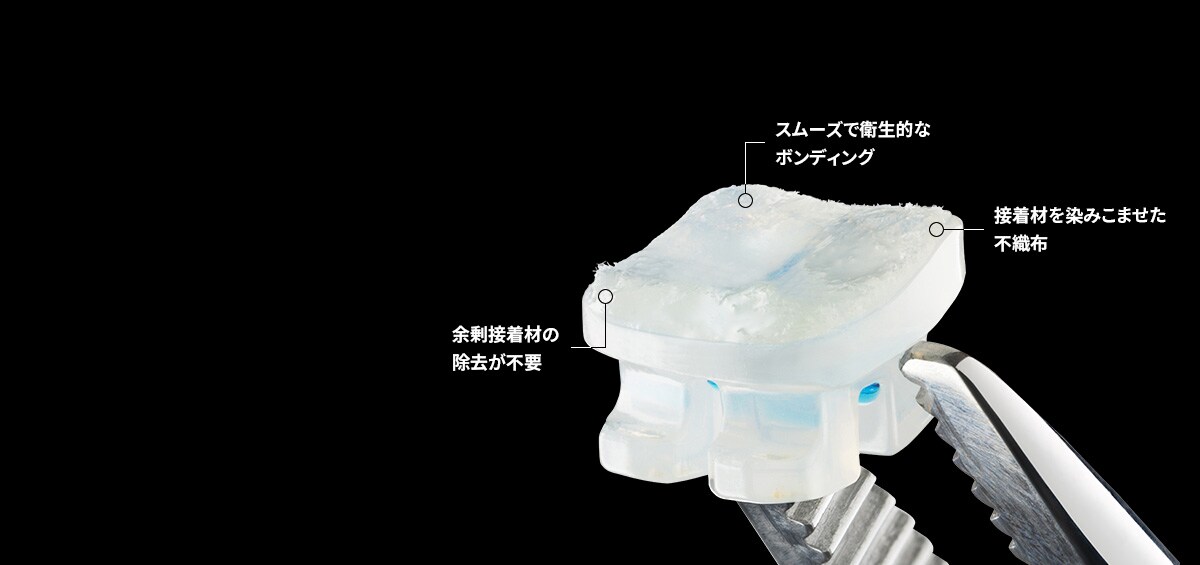 APC(TM) Flash-Free 接着材つき アプライアンス システム

