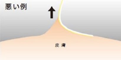 はがし方（悪い例）