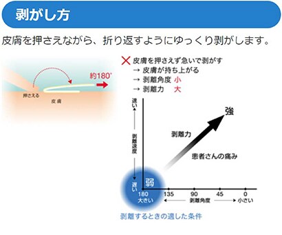 テープの剥がし方
