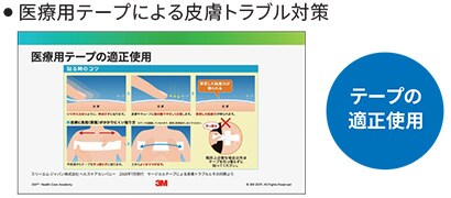 医療用テープによる皮膚トラブル対策
