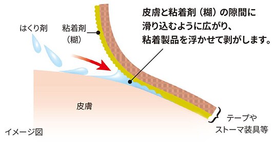 ３Ｍ™ キャビロン™ 皮膚用リムーバー
