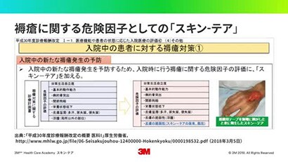 スキン-テアについての動画
