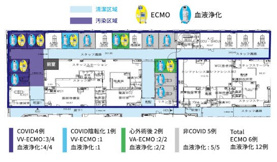 図1　COVID-19 第4波におけるICUのゾーニング
