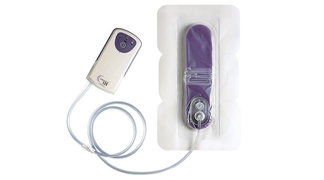 PREVENA PEEL & PLACEシステムキット