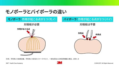 「電気メス手術における安全 ① -電気手術の基礎-」
