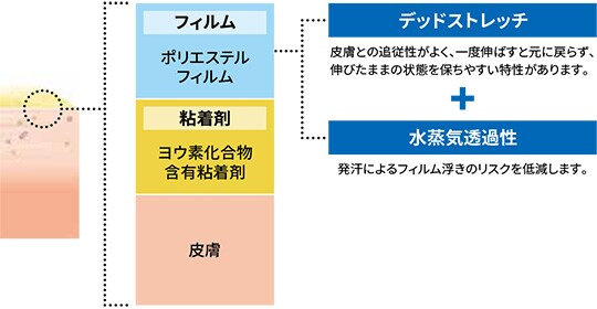 3M™ アイオバン™ スペシャル インサイズドレープは、強力な粘着力が長時間持続します。
