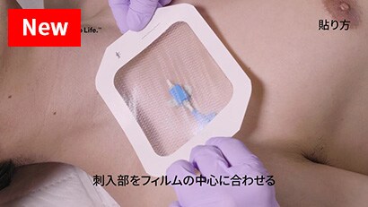 中心静脈カテーテルの固定３動画
