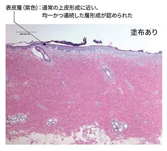 ３Ｍ™ キャビロン™ 皮膚用保護皮膜の塗布あり
