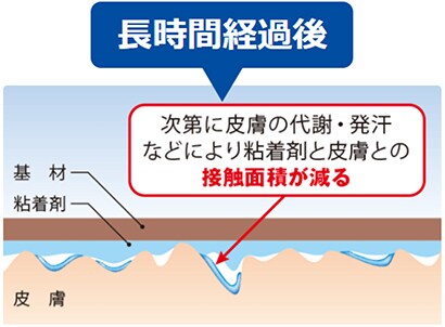 テープ貼付長時間経過後
