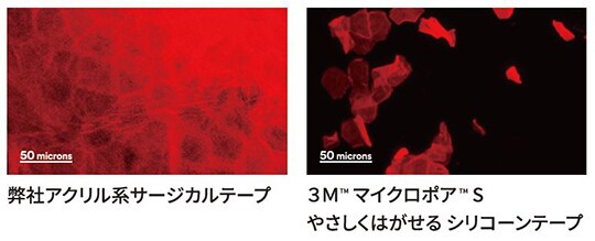 剥がしたテープに付着した角質剥離量の比較
