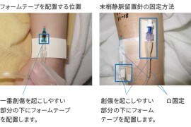 医療関連機器圧迫創傷対策