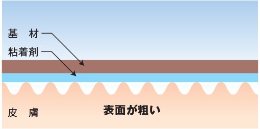 表面が粗い
