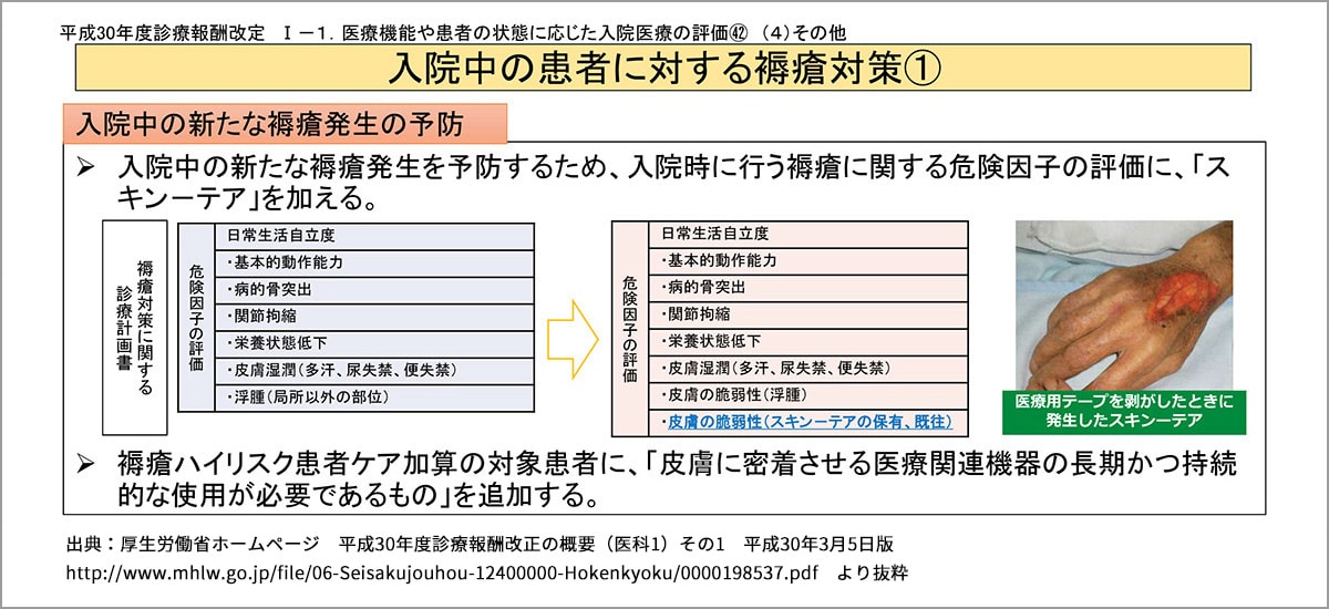 入院中の患者に対する褥瘡対策