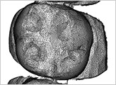 3Dスキャンされた画像。