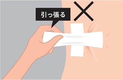 テープ貼り方３
