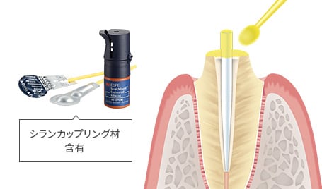 一本で強固に一体化

