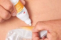 3M™ キャビロン™ 皮膚用リムーバー 滴下ボトルタイプ ストーマ装具を剥がす場合の使用イメージ
