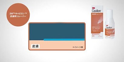 動画で学ぶ　かぶれの原因と対策
