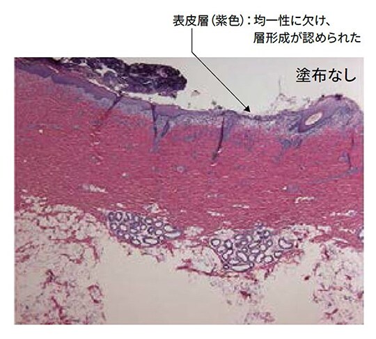 ３Ｍ™ キャビロン™ 皮膚用保護皮膜の塗布なし

